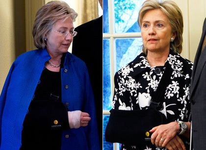 Chùm ảnh: Khi các chính trị gia phải mang nạng, bó bột - 1