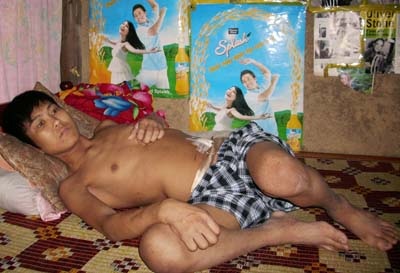 "Tôi mong có tiền để mổ lấy thận thay cho con" - 2