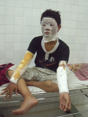 3 bình gas nổ liên tiếp trong quán cơm - 2
