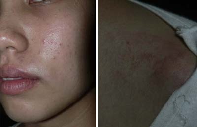 Bị bạn trai hành hung vì... từ chối tình cảm - 1