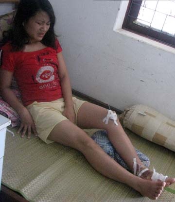 Suýt mất mạng vì tấm cốp pha “từ trên trời rơi xuống” - 1