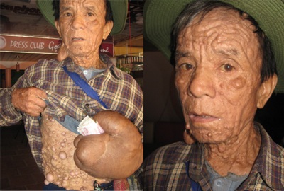 “Dị nhân” ăn xin khắp thành Vinh - 2