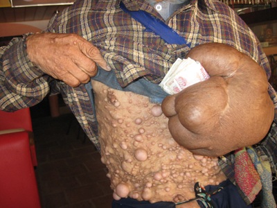 “Dị nhân” ăn xin khắp thành Vinh - 4