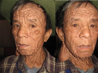 “Dị nhân” ăn xin khắp thành Vinh - 3