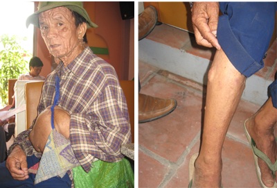 “Dị nhân” ăn xin khắp thành Vinh - 5