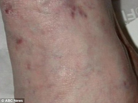 Hai chân của Michael Jackson đầy vết kim tiêm - 4