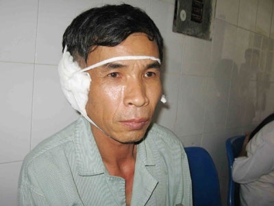 Bệnh ở tai: Nặng vì chủ quan - 1 Bệnh ở tai: Nặng vì chủ quan - 1