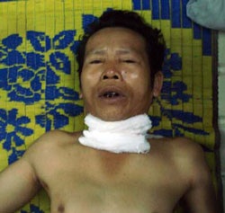 Suýt mất mạng vì ngã vào chậu cây cảnh - 1 Suýt mất mạng vì ngã vào chậu cây cảnh - 1