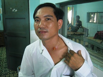 Một vụ hóc xương cá vô cùng hy hữu - 2