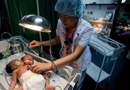 Thêm một trường hợp trẻ hai đầu ở Philippines - 1