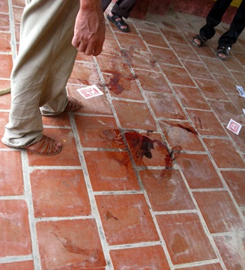 Bị bạn nghiện đâm thấu phổi, xuyên tim - 2