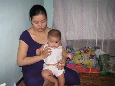 Em bé 8 tháng tuổi đáng thương cần giúp đỡ - 1