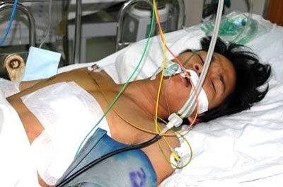 Cứu sống một công nhân bị đâm thấu tim - 1 Cứu sống một công nhân bị đâm thấu tim - 1