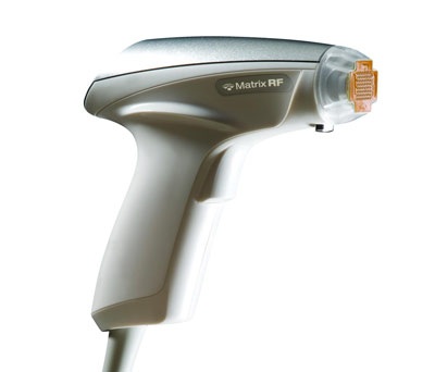 Công nghệ "san bằng" sẹo lõm mới - 1