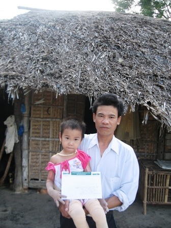 Quà nhân ái tiếp tục đến với gia đình 2 bố con bị bỏng nặng - 1 Quà nhân ái tiếp tục đến với gia đình 2 bố con bị bỏng nặng - 1