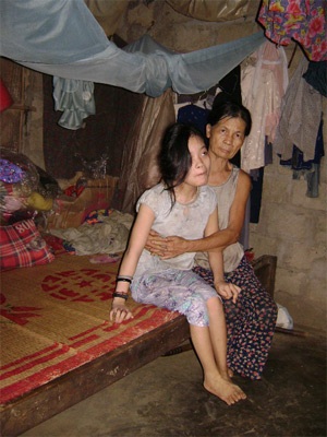 Cô bé 15 tuổi thay cha mẹ nuôi chị bại não và 2 em thơ - 2