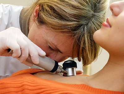 Những dấu hiệu của ung thư da - 13