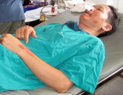 Trưởng khoa hành hung Phó khoa ngay tại phòng mổ - 1 Trưởng khoa hành hung Phó khoa ngay tại phòng mổ - 1