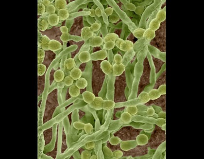 Khám phá những dị nguyên gây dị ứng - 5