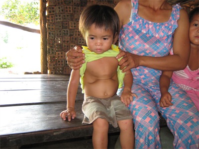 Mới 4 tuổi đầu, em đã mắc căn bệnh hiểm nghèo - 1 Mới 4 tuổi đầu, em đã mắc căn bệnh hiểm nghèo - 1