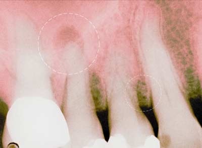 Top những vấn đề ở miệng - 10 Top những vấn đề ở miệng - 10