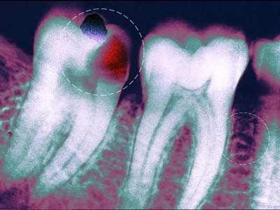 Top những vấn đề ở miệng - 11 Top những vấn đề ở miệng - 11