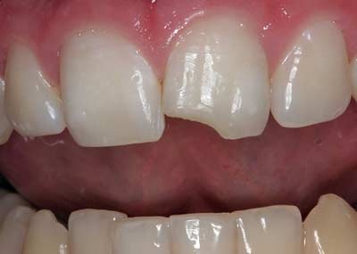 Top những vấn đề ở miệng - 12 Top những vấn đề ở miệng - 12