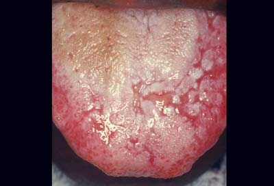 Top những vấn đề ở miệng - 6 Top những vấn đề ở miệng - 6