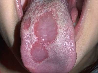 Top những vấn đề ở miệng - 7 Top những vấn đề ở miệng - 7