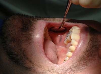 Top những vấn đề ở miệng - 15 Top những vấn đề ở miệng - 15