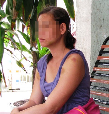 Vụ bé gái 6 tuổi bị hành hạ: Đốt con vì hận vợ cũ - 1