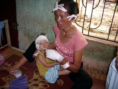 Đối tượng tâm thần vô cớ chém trọng thương 7 người - 1 Đối tượng tâm thần vô cớ chém trọng thương 7 người - 1