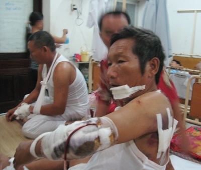 10 côn đồ chém 4 người cùng gia đình trọng thương - 1