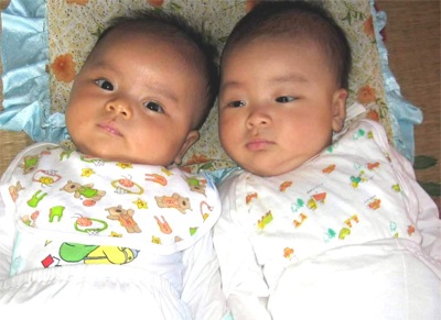 Nguy hiểm đục thuỷ tinh thể trẻ em - 2 Nguy hiểm đục thuỷ tinh thể trẻ em - 2