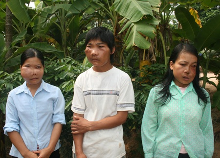 Cận cảnh gia đình có 5 số phận đáng thương - 1