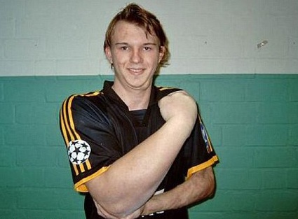 Chàng trai sở hữu cánh tay to như bắp chuối - 1