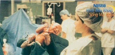 Sinh mổ: Ảnh hưởng tới mẹ và bé như thế nào? - 1 Sinh mổ: Ảnh hưởng tới mẹ và bé như thế nào? - 1