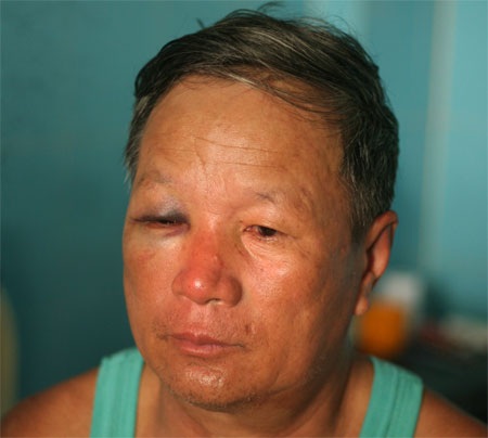 Gọi côn đồ đánh người để… cướp thùng phiếu bầu - 2 Gọi côn đồ đánh người để… cướp thùng phiếu bầu - 2