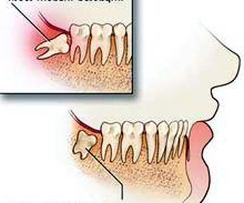 5 bộ phận thừa trên cơ thể - 1