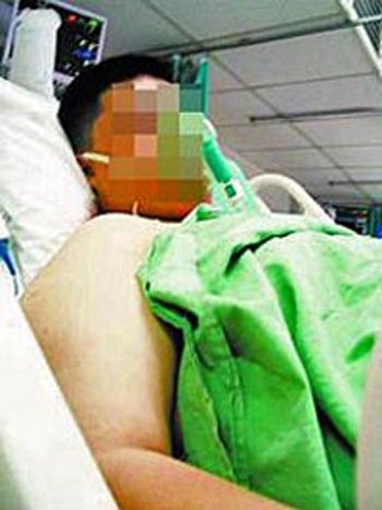 Nuốt 13 bàn chải đánh răng trong 2 năm  - 1