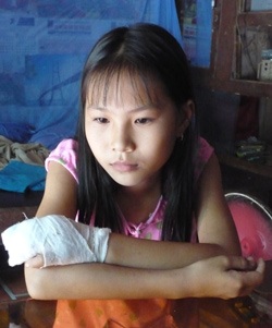 Khởi tố vụ án “bé gái bị cậu chặt cụt tay” - 1 Khởi tố vụ án “bé gái bị cậu chặt cụt tay” - 1