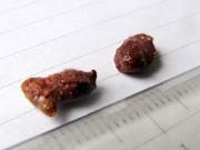 Xuất hiện vật lạ tự cháy trên bãi biển - 1