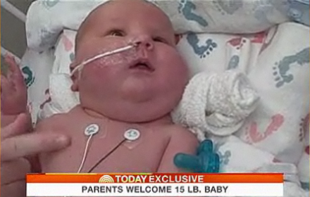 Bé sơ sinh nặng 7kg - 1