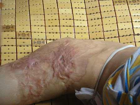 Xem “chú lính chì” một chân đi xe đạp, leo cây - 2