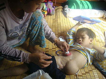 Xem “chú lính chì” một chân đi xe đạp, leo cây - 4