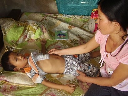 Cháu Phạm Văn Hùng được phẫu thuật tim thuận lợi và an toàn - 1