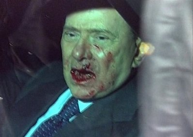 Thủ tướng Italia Berlusconi nhập viện vì bị tấn công - 1 Thủ tướng Italia Berlusconi nhập viện vì bị tấn công - 1