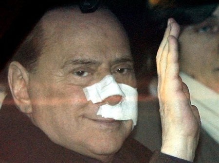 Thủ tướng Italia Berlusconi rời bệnh viện với mặt băng bó - 1