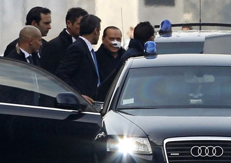 Thủ tướng Italia Berlusconi rời bệnh viện với mặt băng bó - 4 Thủ tướng Italia Berlusconi rời bệnh viện với mặt băng bó - 4