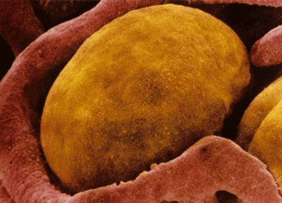 Thon thả nhờ mỡ nâu - 1